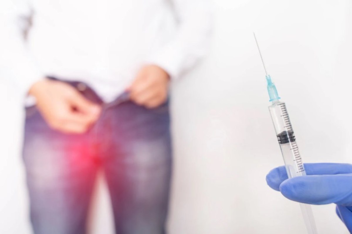 Varicocele, non sottovalutare